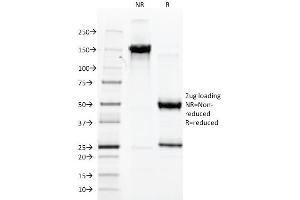 SDS-PAGE Analysis Purified vWF Mouse Monoclonal Antibody (3E2D10). (VWF antibody  (AA 845-949))