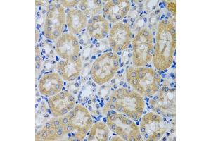 Immunohistochemistry of paraffin-embedded mouse kidney using  antibody (ABIN6127321, ABIN6136446, ABIN6136448 and ABIN6216005) at dilution of 1:100 (40x lens). (ACP1 antibody  (AA 1-158))