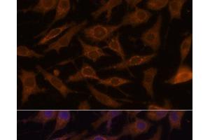 Immunofluorescence analysis of L929 cells using UCP1 Polyclonal Antibody at dilution of 1:100. (UCP1 antibody)