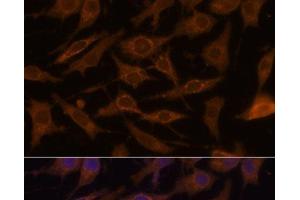 Immunofluorescence analysis of L929 cells using UCP1 Polyclonal Antibody at dilution of 1:100. (UCP1 antibody)