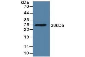 Detection of Recombinant DDAH1, Human using Polyclonal Antibody to Dimethylarginine Dimethylaminohydrolase 1 (DDAH1) (DDAH1 antibody  (AA 20-215))