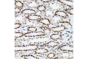 Immunohistochemistry of paraffin-embedded rat kidney using Phospho-FOXO3A-S425 Rabbit pAb (ABIN7267246) at dilution of 1:250 (40x lens). (FOXO3 antibody  (pSer425))