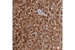 Immunohistochemical staining (Formalin-fixed paraffin-embedded sections) of human liver with ARG1 polyclonal antibody  shows strong cytoplasmic and nuclear positivity in hepatocytes at 1:2500-1:5000 dilution. (Liver Arginase antibody)