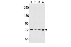 Western blot analysis in Hela(lane 1),A549(lane 2),K562(lane 3),MDA-MB435(lane 4) cell line lysates (35ug/lane). (ALOX15 antibody  (C-Term))