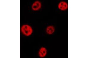 ABIN6277062 staining  HT29 cells by IF/ICC. (FANCD2 antibody  (Internal Region))