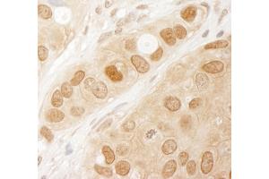 Immunohistochemistry (IHC) image for anti-V-Akt Murine Thymoma Viral Oncogene Homolog 1 (AKT1) (AA 25-75) antibody (ABIN7454546) (AKT1 antibody  (AA 25-75))