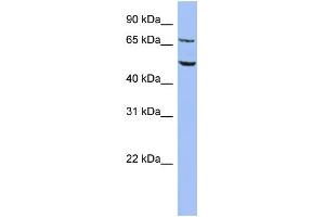 WB Suggested Anti-REPIN1 Antibody Titration:  0. (REPIN1 antibody  (Middle Region))