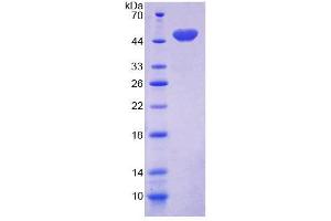 Image no. 1 for CD164 (CD164) (AA 24-162) protein (GST tag,His tag) (ABIN4988759)