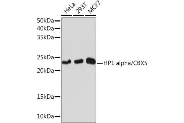CBX5 anticorps