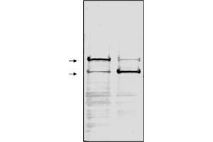 Western blot analysis of whole cell extracts from (1) human HL60 leukemia cells  and (2) HL60 cells induced to undergo apoptosis using etoposide . (PARP1 antibody)
