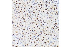 Immunohistochemistry of paraffin-embedded rat ovary using A Rabbit pAb (ABIN6129868, ABIN6136479, ABIN6136480 and ABIN6221034) at dilution of 1:100 (40x lens). (BAF53A antibody  (AA 1-280))