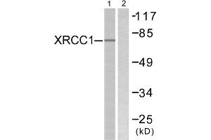 Western blot analysis of extracts from Jurkat cells, using XRCC1 antibody.