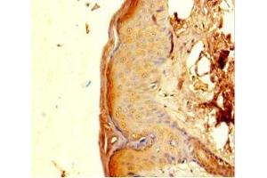 Immunohistochemistry of paraffin-embedded human skin tissue using ABIN7162782 at dilution of 1:100 (PGLYRP4 antibody  (AA 18-317))