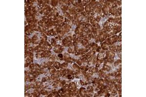 Immunohistochemical staining of human pancreas with C12orf60 polyclonal antibody  shows strong cytoplasmic positivity in exocrine glandular cells at 1:500-1:1000 dilution. (C12orf60 antibody)