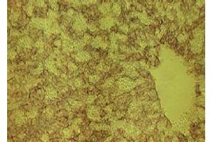Immunohistochemistry (IHC) image for anti-delta-Like 1 Homolog (Drosophila) (DLK1) antibody (ABIN1449213) (DLK1 antibody)
