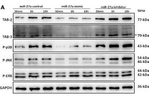 miR-27a modulates mitogen-activated protein kinase (MAPK) signaling cascades by targeting TGF-β-activated protein kinase 1 binding protein 2 (TAB 2) and TAB 3 in Mycobacterium avium subspecies paratuberculosis (MAP)-infected macrophages. (TAB1 antibody  (AA 601-712))