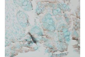 Immunohistochemistry analysis using Rabbit Anti-ERK1 Polyclonal Antibody . (ERK1 antibody  (FITC))