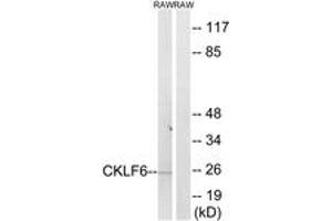 Western Blotting (WB) image for anti-CKLF-Like MARVEL Transmembrane Domain Containing 6 (CMTM6) (AA 131-180) antibody (ABIN2890222) (CMTM6 antibody  (AA 131-180))