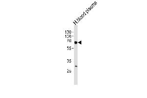 FGA Antibody (N-term) (ABIN390830 and ABIN2841057) western blot analysis in human blood plasma tissue lysates (35 μg/lane). (FGA antibody  (N-Term))