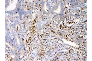 Immunohistochemistry (IHC) image for anti-S100 Calcium Binding Protein A7 (S100A7) antibody (ABIN5708274)