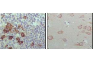 Immunohistochemical analysis of paraffin-embedded human lymph node (left) and brain (right), showing cytoplasmic localization with DAB staining using EhpB6 mouse mAb. (EPH Receptor B6 antibody  (AA 601-750))