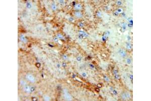 Used in DAB staining on fromalin fixed paraffin-embedded Brain tissue (CCL4L1 antibody  (AA 24-92))