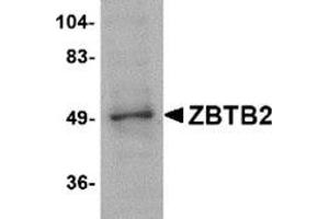 Western blot analysis of ZBTB2 in PC-3 cell lysate with this product at 1 μg/ml. (ZBTB2 antibody  (Center))