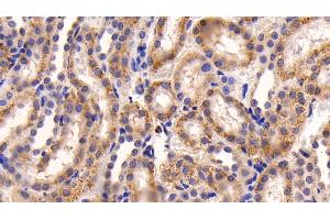 Detection of CASP3 in Rat Kidney Tissue using Polyclonal Antibody to Caspase 3 (CASP3) (Caspase 3 antibody  (AA 183-277))