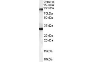 Western Blotting (WB) image for anti-Bone Morphogenetic Protein 8A (BMP8A) (Middle Region) antibody (ABIN2789951)