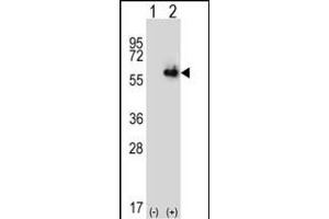 Western blot analysis of ALDH4A1 (arrow) using rabbit polyclonal ALDH4A1 Antibody (Center) (ABIN392357 and ABIN2841996).