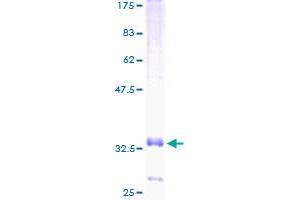 CCL20 Protein (AA 27-95) (GST tag)