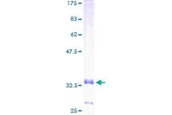 CCL20 Protein (AA 27-95) (GST tag)