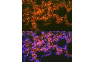 Immunofluorescence analysis of rat lung using Mesothelin Rabbit mAb (ABIN7268478) at dilution of 1:100 (40x lens). (Mesothelin antibody)