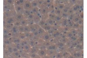 Immunohistochemistry (IHC) image for anti-Complement 4 (C4) (AA 1450-1723) antibody (ABIN7432859)