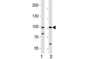 Western blot analysis of lysate from (1) human A2058 and (2) rat PC-12 cell line using PROX1 antibody at 1:1000. (PROX1 antibody  (AA 492-522))