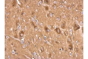 IHC-P Image Synaptophysin antibody detects Synaptophysin protein at on rat fore brain by immunohistochemical analysis. (Synaptophysin antibody  (C-Term))