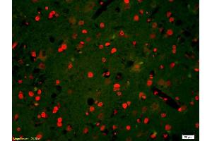 Formalin-fixed and paraffin-embedded rat brain labeled with Anti-Phospho-HER3(Tyr1328) Polyclonal Antibody, Unconjugated (ABIN800628) 1:200, overnight at 4°C, The secondary antibody was Goat Anti-Rabbit IgG, Cy3 conjugated used at 1:200 dilution for 40 minutes at 37°C. (ERBB3 antibody  (pTyr1328))