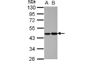 Western Blotting (WB) image for anti-Vitamin K-dependent protein C (PROC) (AA 1-236) antibody (ABIN1500426)