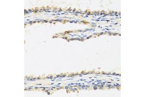 Immunohistochemistry of paraffin-embedded human prostate using SPINT1 antibody at dilution of 1:100 (40x lens). (SPINT1 antibody)