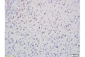Formalin-fixed and paraffin embedded mouse spleen tissue labeled with Anti-HDAC5 Polyclonal Antibody, Unconjugated (ABIN681043) at 1:200 followed by conjugation to the secondary antibody and DAB staining (HDAC5 antibody)