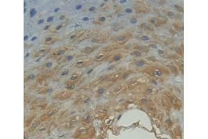 Used in DAB staining on fromalin fixed paraffin- embedded esophagus tissue (FPGT antibody  (AA 127-377))