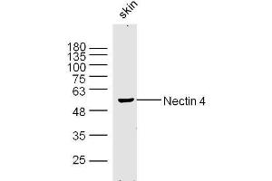 Mouse skin lysates probed with Nectin 4 Polyclonal Antibody, Unconjugated  at 1:300 dilution and 4˚C overnight incubation. (PVRL4 antibody  (AA 151-250))
