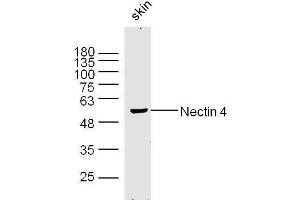 Mouse skin lysates probed with Nectin 4 Polyclonal Antibody, Unconjugated  at 1:300 dilution and 4˚C overnight incubation.