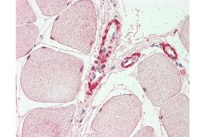 Anti-INPP5K / SKIP antibody IHC staining of human skeletal muscle. (INPP5K antibody  (AA 183-430))