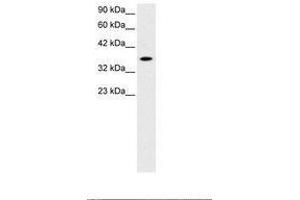 Image no. 1 for anti-Retina and Anterior Neural Fold Homeobox (RAX) (AA 94-143) antibody (ABIN6735798) (RAX antibody  (AA 94-143))