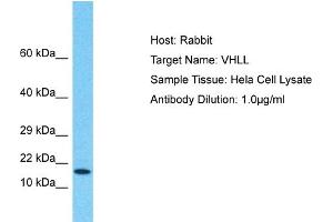 Host: Rabbit Target Name: VHLL Sample Type: Hela Whole Cell lysates Antibody Dilution: 1.