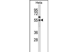 FOXN4 Antibody (N-term) (ABIN657413 and ABIN2846451) western blot analysis in Hela cell line lysates (35 μg/lane).