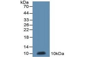 Detection of Recombinant ND5, Rat using Polyclonal Antibody to NADH Dehydrogenase 5 (ND5)