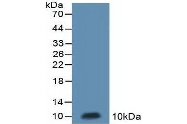 MT-ND5 Antikörper  (AA 425-562)