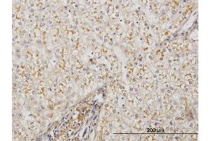 Immunoperoxidase of monoclonal antibody to AMBP on formalin-fixed paraffin-embedded human liver. (AMBP antibody  (AA 19-352))